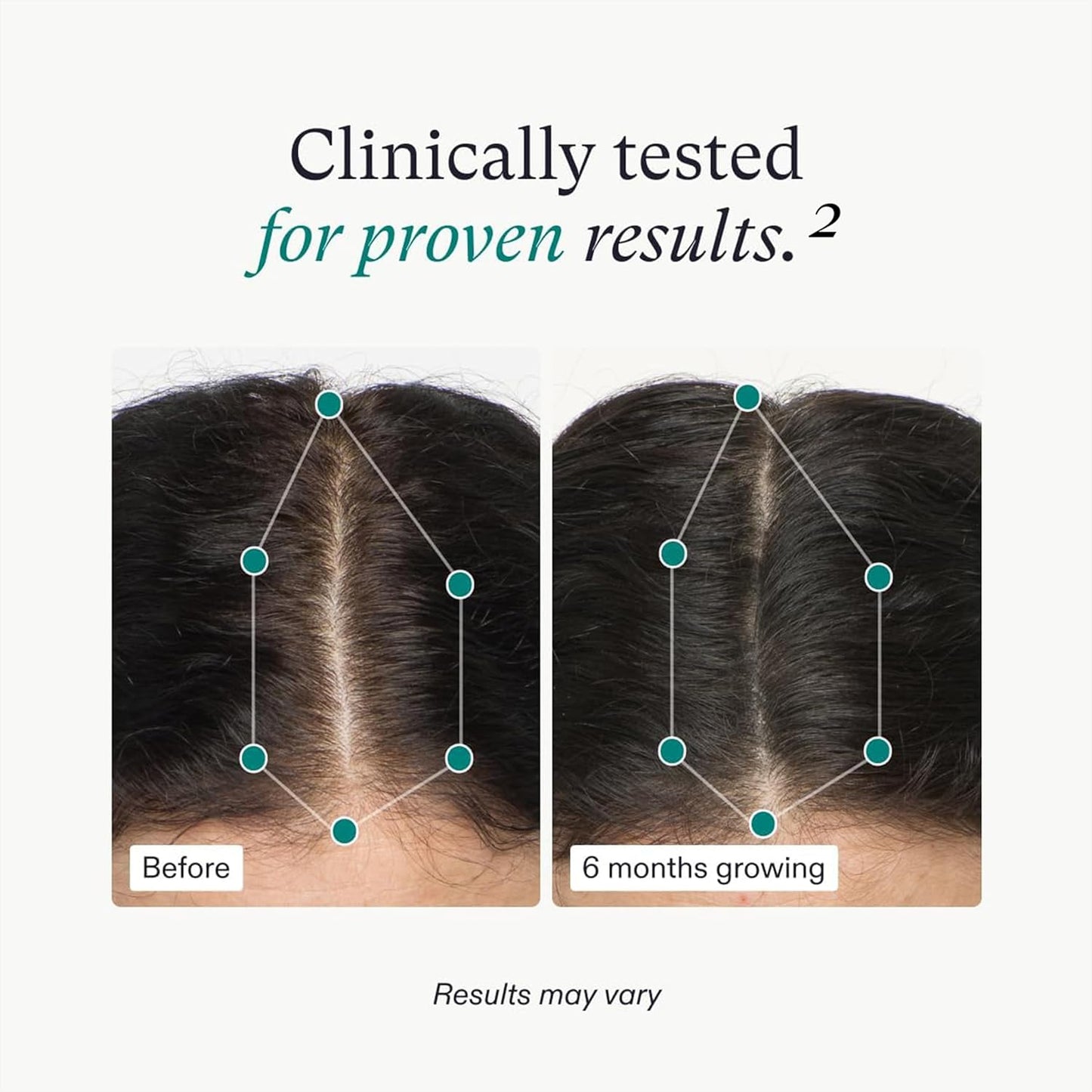 Nutrafol Hair Growth Supplements, For Women Ages 18 and Over