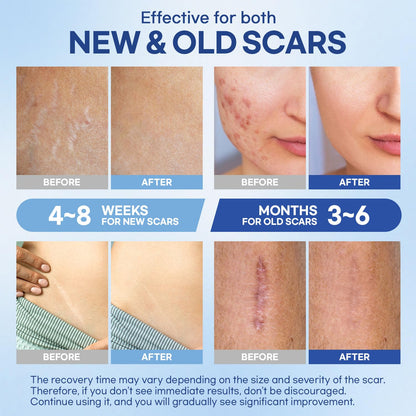 Aroamas Scar Silicone Scar Sheets